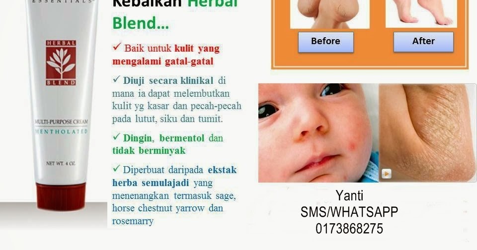 *Mama DoubleR*  Semua tentang CinTa: UBAT KREAM STEROID 